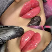 جشنواره لیفت فیلربوتاکس بلفارو نخ تزریق چربی فشیال|خدمات آرایشگری و زیبایی|اصفهان, ملکشهر|دیوار