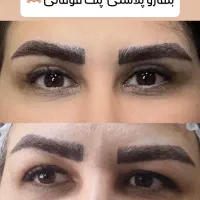 خدمات زیبایی توسط متخصص بلفارو بوتاکس لیفت زاویه|خدمات آرایشگری و زیبایی|اصفهان, گلزار|دیوار