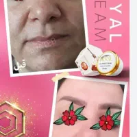 کرم ژل رویال روشن کننده پوست|آرایشی، بهداشتی، درمانی|تربت‌حیدریه, آغوی|دیوار