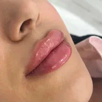 جشنواره بهاره ژل و بوتاکس/شرایط از دم قسط/وام