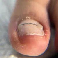 خدمات ارتونیل(ارتودنسی ناخن)وکفسابی ،درمان میخچه|خدمات آرایشگری و زیبایی|تهران, دردشت|دیوار
