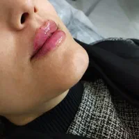 جشنواره خدمات زیبایی در کلینیک زیبایی توسط پزشک|خدمات آرایشگری و زیبایی|قم, زنبیل آباد|دیوار