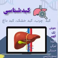 کبد چرب