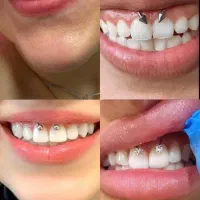 خدمات پیرسینگ لیفت ابرو و مژه تضمینی