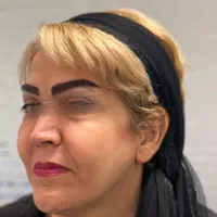 کلینیک تخصصی کاشت مو و ابرو با متد پیشرفته|خدمات آرایشگری و زیبایی|تهران, جنت‌آباد جنوبی|دیوار
