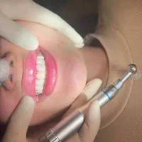 جشنواره کامپوزیت،لمینیت وبلیچینگ وخدمات دندانپزشکی|خدمات آرایشگری و زیبایی|شاهین‌شهر, مخابرات (شهید بهشتی)|دیوار