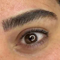 مدل میکروبلیدینگ