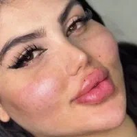 تخفیف ژل و فیلر فول فیس 3900 به جای ۷/۹۰۰|خدمات آرایشگری و زیبایی|اصفهان, خانه اصفهان|دیوار