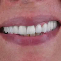 دندانپزشکی|آرایشی، بهداشتی، درمانی|ارومیه, |دیوار