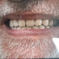 دندانسازی معروف محلات