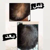 تونیک هیرفرند|آرایشی، بهداشتی، درمانی|اصفهان, ارداجی|دیوار