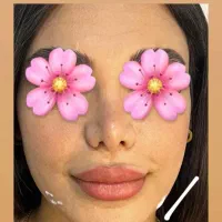 ژل وبوتاکس|خدمات آرایشگری و زیبایی|اهواز, کوی مندلی(سه راه خرمشهر)|دیوار