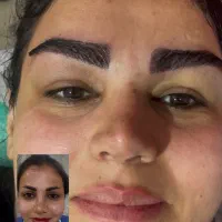 کاشت مو وابرو بدون سیخ سیخ شدن وبهترین خواب|خدمات آرایشگری و زیبایی|مشهد, احمدآباد|دیوار