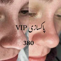 جشنواره زیبایی پاکسازی فیشیال۳۸۰اصلاح و ابرو۱۸۰و..