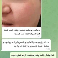 مراقبت پوست|آرایشی، بهداشتی، درمانی|تهران, جی|دیوار
