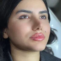 تزریق ژل وبوتاکس|خدمات آرایشگری و زیبایی|جوانرود, |دیوار