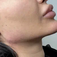 جشنواره مدلینگ ۱۰ سی سی امروز۳۳۰۰فیلر لب لیفت ابرو|خدمات آرایشگری و زیبایی|تهران, مرزداران|دیوار