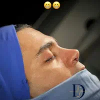 لیفت شقیقه و ....دراهواز
