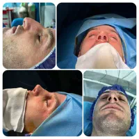 جراحی زیبایی بینی و ترمیمی|خدمات آرایشگری و زیبایی|قائمشهر, |دیوار