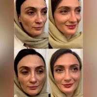 کرم ضدلک لاکچری کوین اصل نمایندگی کوثر|آرایشی، بهداشتی، درمانی|کوثر, |دیوار