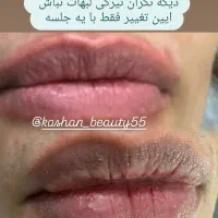 درمان تمام مشکلات پوستی شما و خدمات زیبایی