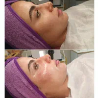 مرکز مراقبت زیبایی ماه چهره فقط ویژه بانوان|خدمات آرایشگری و زیبایی|تهران, تهران پارس|دیوار