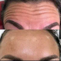 فیلر بادی(هیپ دیپ،بیکینی،ساق)محصولات سفیدکردن پوست|خدمات آرایشگری و زیبایی|بندر ماهشهر, |دیوار