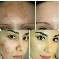 کرم معجزه آسا شب|آرایشی، بهداشتی، درمانی|ساری, |دیوار