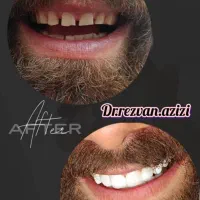دندانپزشکی اقساطی باارائه وام و با کیفیتی استثنایی|خدمات آرایشگری و زیبایی|شیراز, ملاصدرا|دیوار