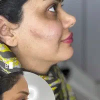خدمات ژل و بوتاکس هر سی سی ژل ۴۸۰|خدمات آرایشگری و زیبایی|اهواز, حصیرآباد|دیوار