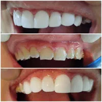 دندانپزشکی لبخند|خدمات آرایشگری و زیبایی|پاکدشت, پاکدشت (مامازند)|دیوار