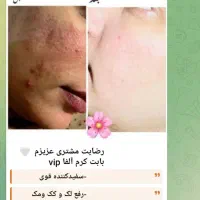 کرم vipاصل تضمینی|آرایشی، بهداشتی، درمانی|یاسوج, |دیوار