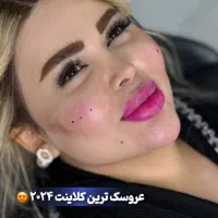 تزریق ژل بوتاکس توسط پزشک