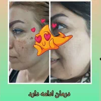 رشد مجدد موها فقط با محصولات طبیعی|آرایشی، بهداشتی، درمانی|فرمهین, |دیوار