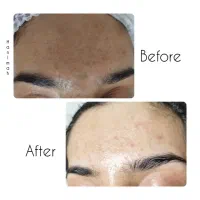 اصلاح صورت رایگان