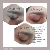 پوست زیبایی|خدمات آرایشگری و زیبایی|رباط‌کریم, الارد|دیوار
