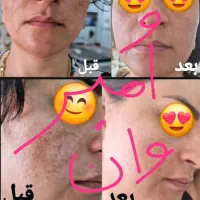 کرم صورت|آرایشی، بهداشتی، درمانی|شیراز, پانصد دستگاه ارتش|دیوار