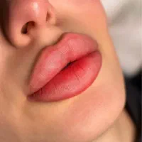 فیلر تک سی‌سی  مزوتراپی هدیه  پاکسازی پوست شهریار