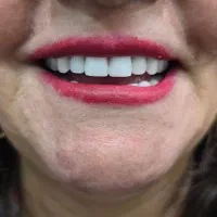 دندانسازی دندان مصنوعی|خدمات آرایشگری و زیبایی|مشهد, اقبال|دیوار