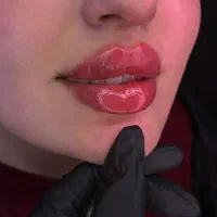 جشنواره کلنیک فوق تخصص زیبایی تزریق ژل و بوتاکس
