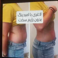 لاغری|آرایشی، بهداشتی، درمانی|شیراز, تندگویان|دیوار
