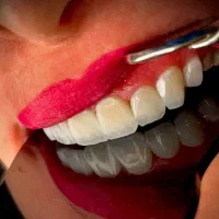 دندانپزشکی اقساط ۱۲ماهه بدون پیش پرداخت|خدمات آرایشگری و زیبایی|تهران, خانی آباد نو شمالی|دیوار