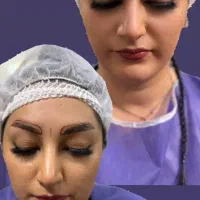 کاشت مو و ابرو فقط با پرداخت هزینه اتاق عمل|خدمات آرایشگری و زیبایی|تهران, ونک|دیوار
