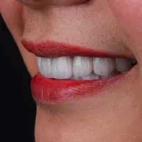 دندانپزشکی / اقساطی/ در فلاورجان و اصفهان