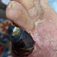 زندگی با طعم سلامتی|فعالیت داوطلبانه|اردبیل, |دیوار