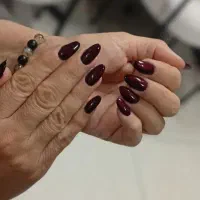 کاشت فقط 180توضیخات بخون به مناسبت ولنتاین