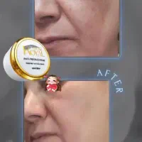 تغییر و زیبایی|حراج|خرمشهر, |دیوار