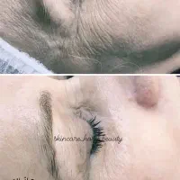 انجام خدمات فشیال و پاکسازی
