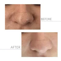 خدمات تخصصی پوست بانوان+مشاوره رایگان