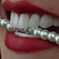 کامپوزیت دندان با چک . اقساط دندانپزشکی . تخفیفات|خدمات آرایشگری و زیبایی|تهران, صادقیه|دیوار